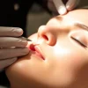 Fadenlifting Zürich treatment session showcasing aesthetic improvement and professional care.