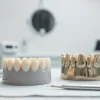 Exhibit of various crowns showcasing dental restoration options with a focus on design and materials.